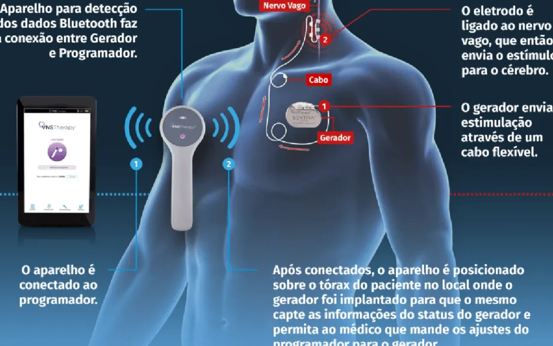 epilepsia, refratária, crises, epilépticas, epilepsia;