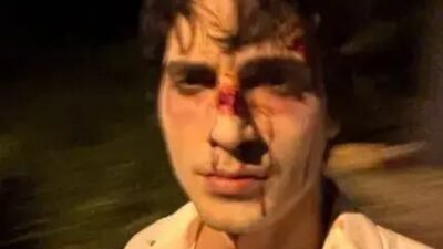 Fiuk causa preocupação ao postar foto com rosto machucado no Instagram