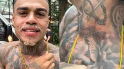 MC Cabelinho revela lesão após tentativa de assalto em Salvador