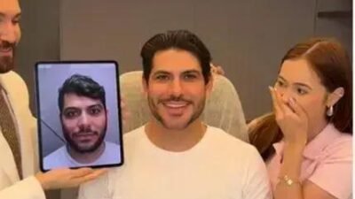 Mirela Janis revela transformação de Yugnir Ângelo após harmonização facial