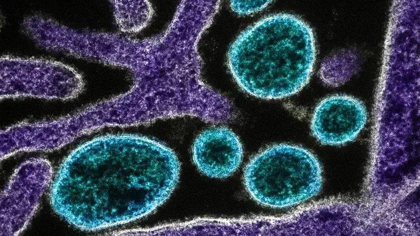 Nipah: risco crescente com casos na Índia e vigilância na China