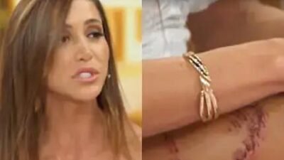 Tayane Dalazen relata ataque de tubarão-lixa em Fernando de Noronha