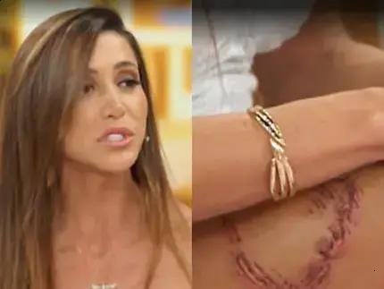 Tayane Dalazen relata ataque de tubarão-lixa em Fernando de Noronha