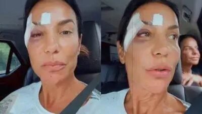 Ivete Sangalo tem alta após infecção intestinal; diz que desmaiou por síncope