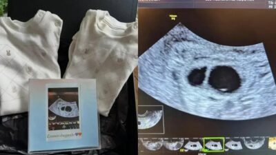 Amanda Djehdian revela nova perda gestacional e lamenta gêmeos