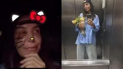 Ivete Sangalo recebe alta após cirurgia por fraturas no rosto