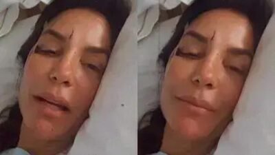 Ivete Sangalo tem cirurgia no rosto e deve receber alta em breve