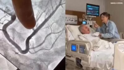 Senador Ângelo Coronel recebe stent após diagnóstico de obstrução