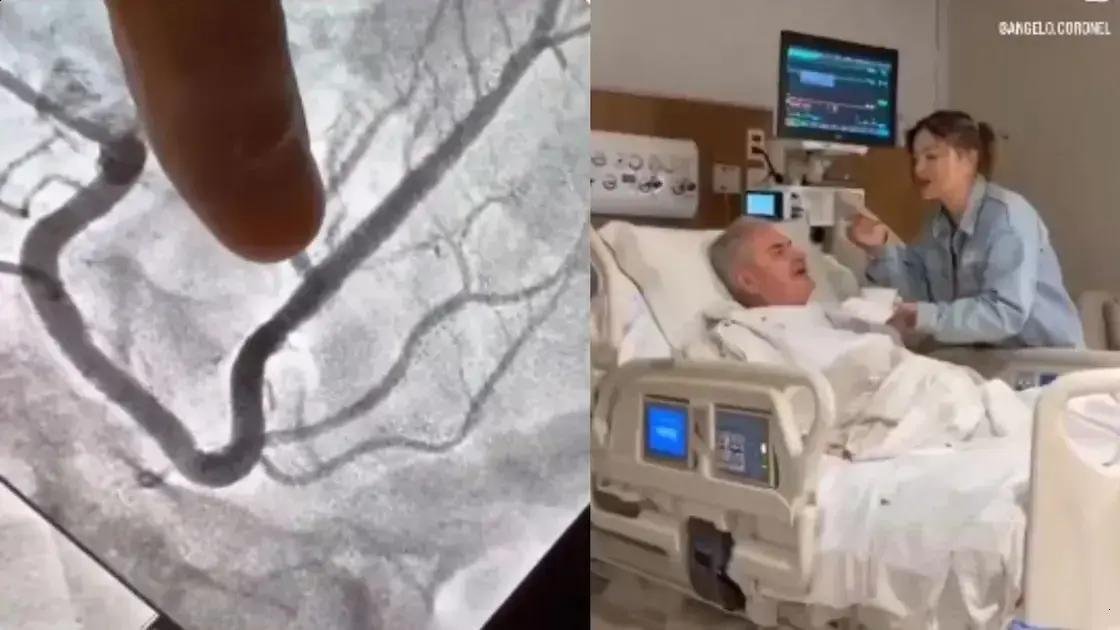 Senador Ângelo Coronel recebe stent após diagnóstico de obstrução