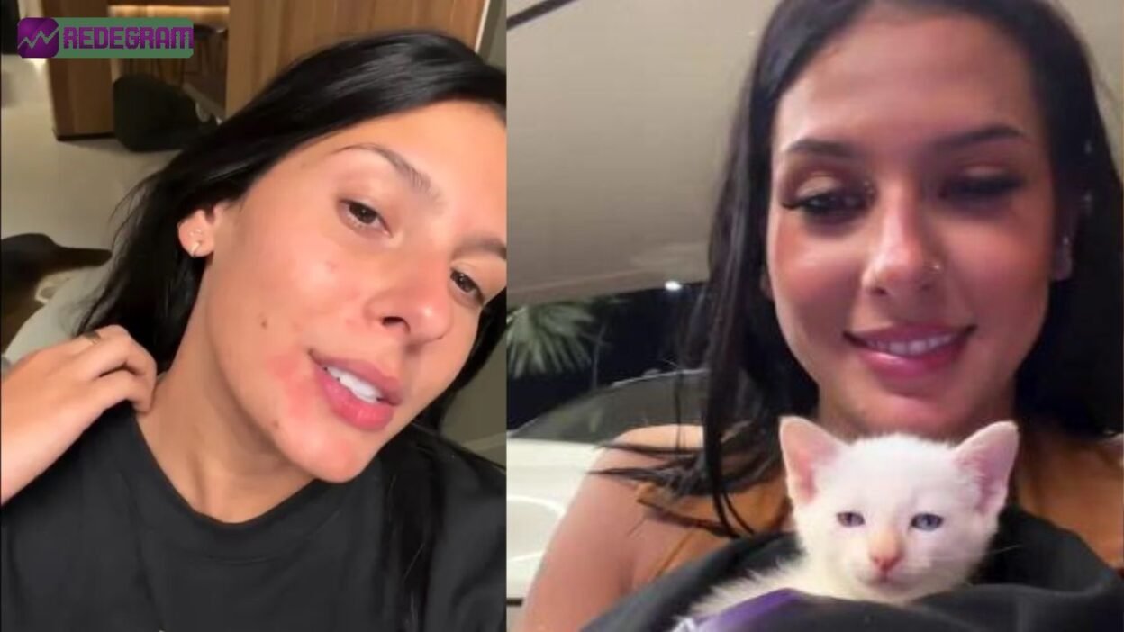 Ana Castela mima gatinho e passa susto com reação alérgica; entenda o caso