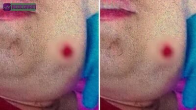 Jovem autista é baleada em Goiânia após sorrir: 'Está rindo da minha cara?'