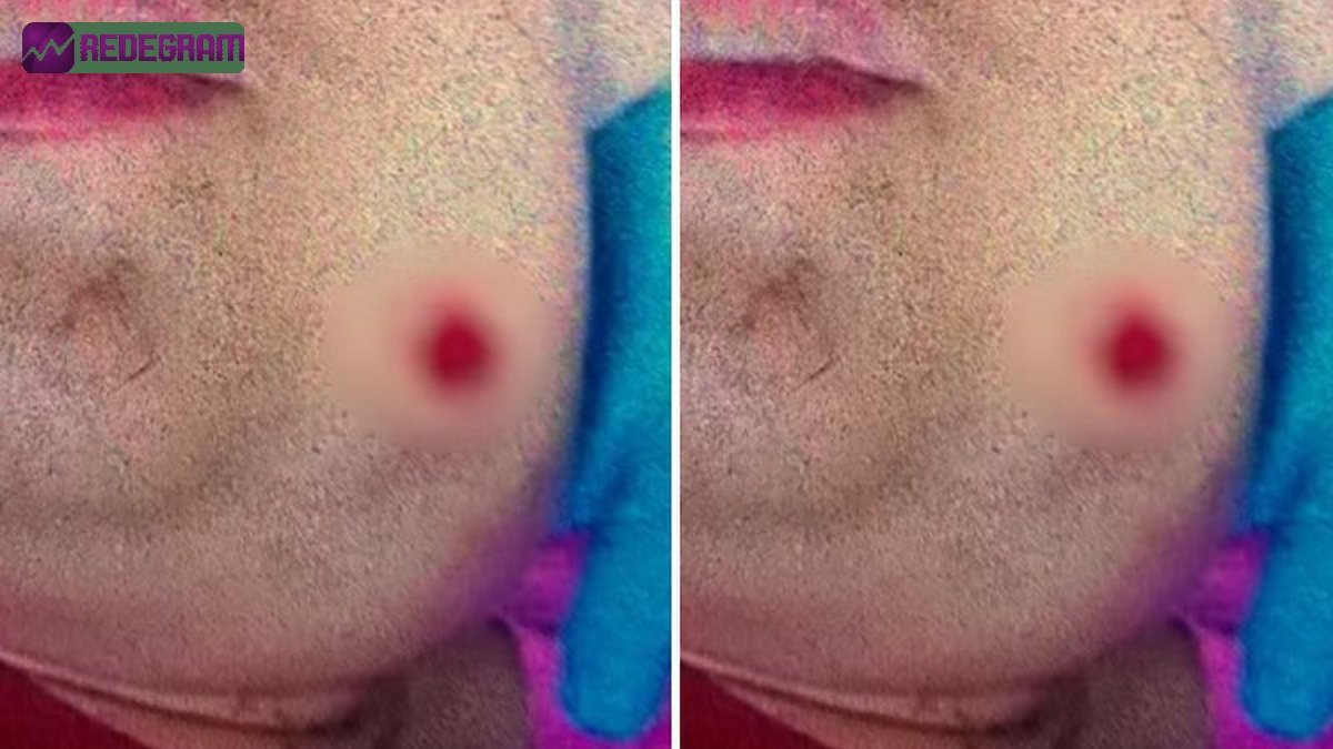 Jovem autista é baleada em Goiânia após sorrir: 'Está rindo da minha cara?'